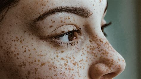 freckles Search